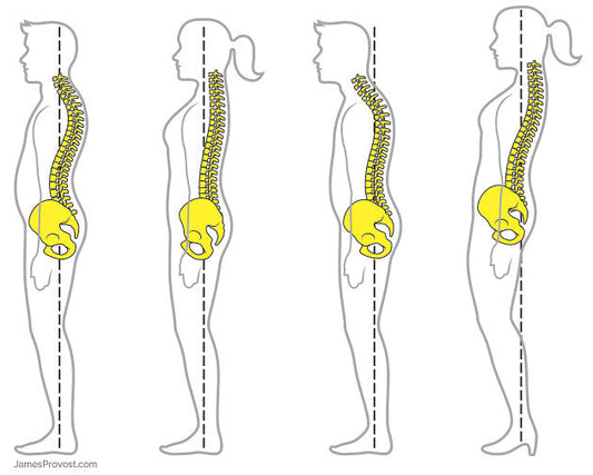 Why you still have back pain despite ‘fixing’ your posture