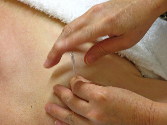Is acupuncture no better than a toothpick?