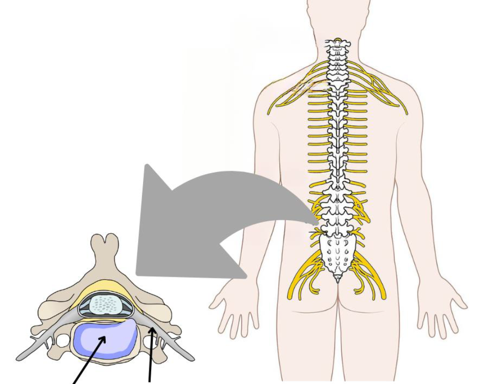 Sciatica: what is it and do you need surgery?