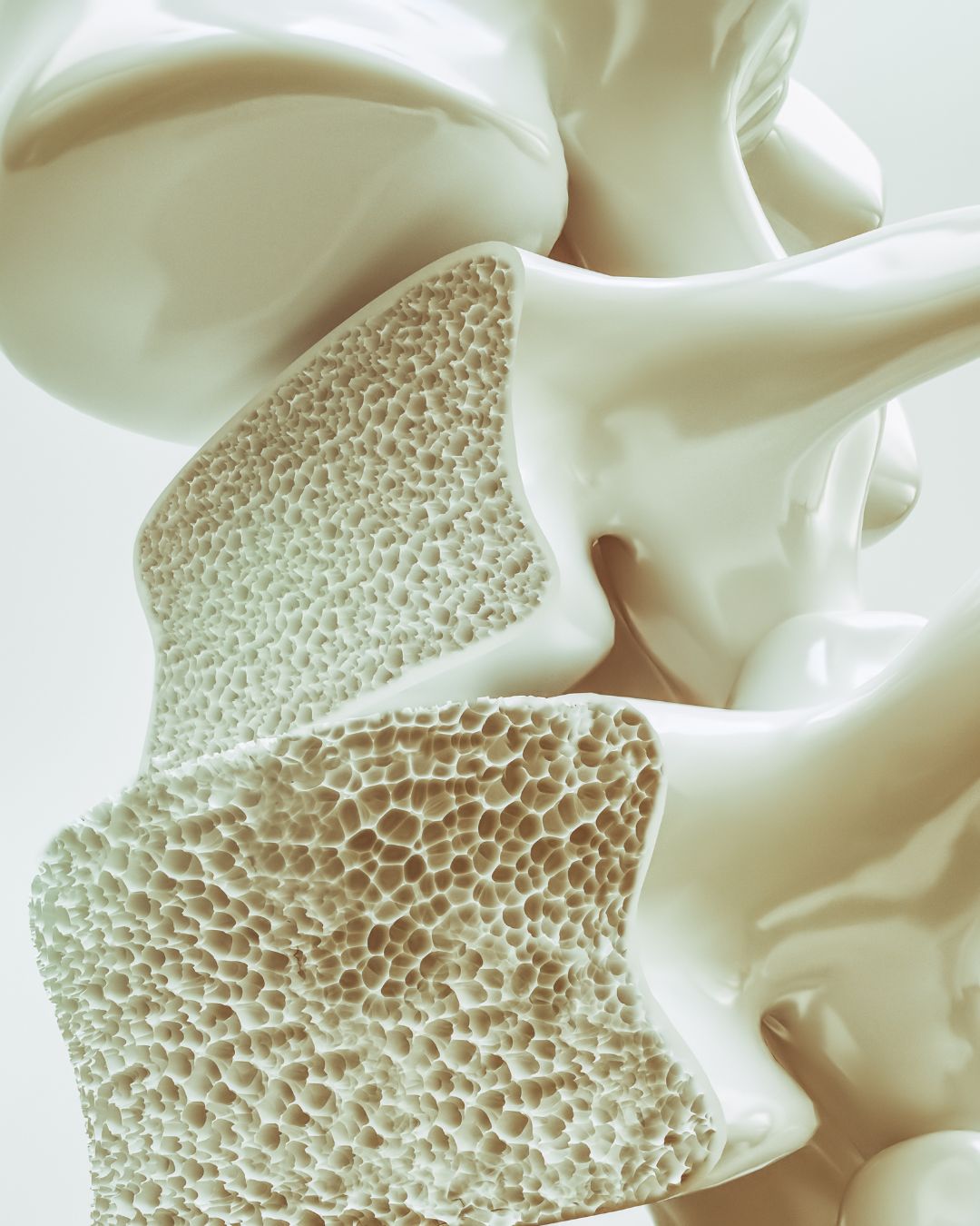 osteoporosis-strength-training.jpg